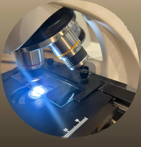 Diagnostic et microscopie capillaire