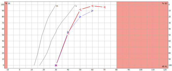 Bilan Auditif Gratuit à Le Lamentin